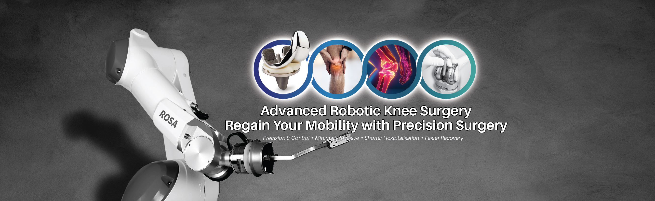 Advanced Robotic Knee Surgery